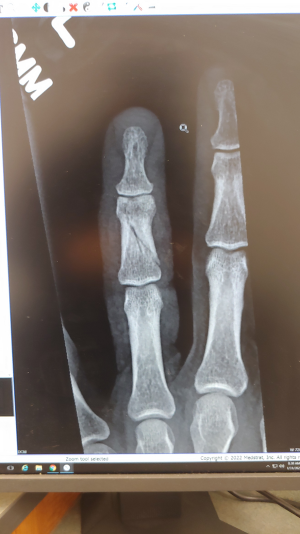 finger2a.png