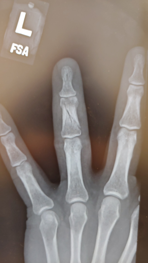 Finger 3.png
