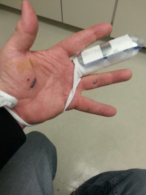 finger.jpg