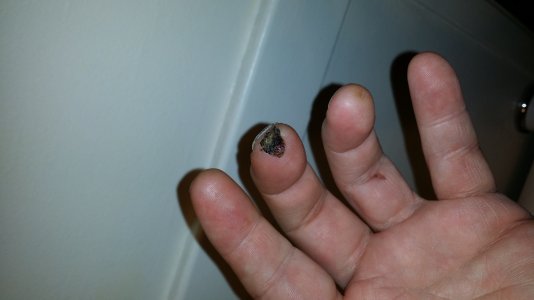 scab.jpg