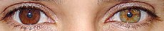 230px-Heterochromia.jpg